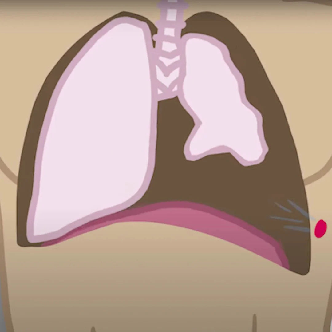 Chest Seal Twin Pack